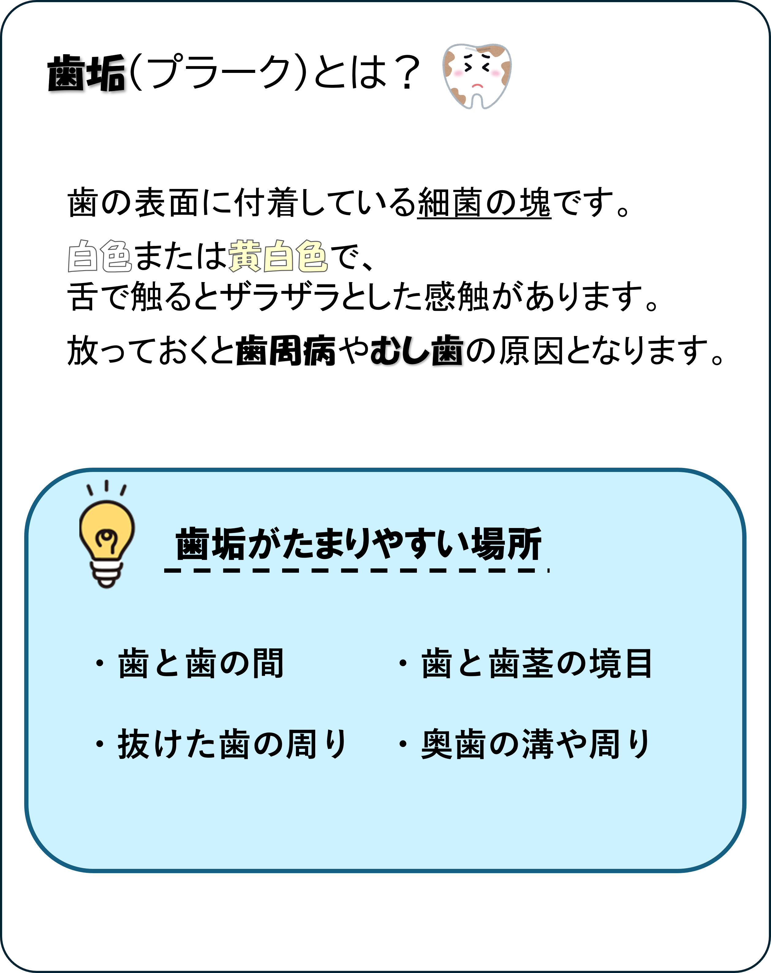 歯垢（プラーク）とは？